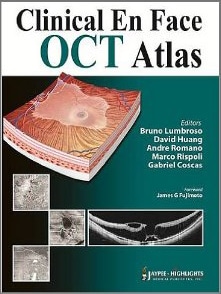 Pubblicazioni Clinical En Face OCT Atlas