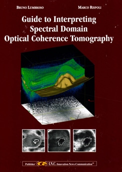 Guide to interpreting Spectral Domain Optical Coherence Tomography